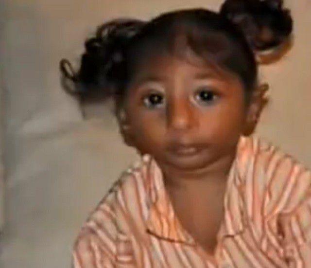 其实,塞克尔综合症是一种非常罕见的遗传疾病,但是遗传的这个原因并不