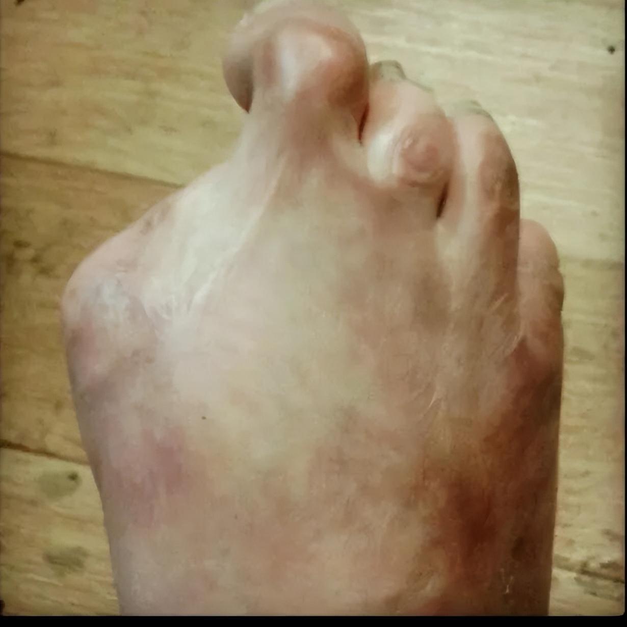 温泉鱼有多恐怖吃脚皮只是在麻痹你整条鱼进去只剩骨架