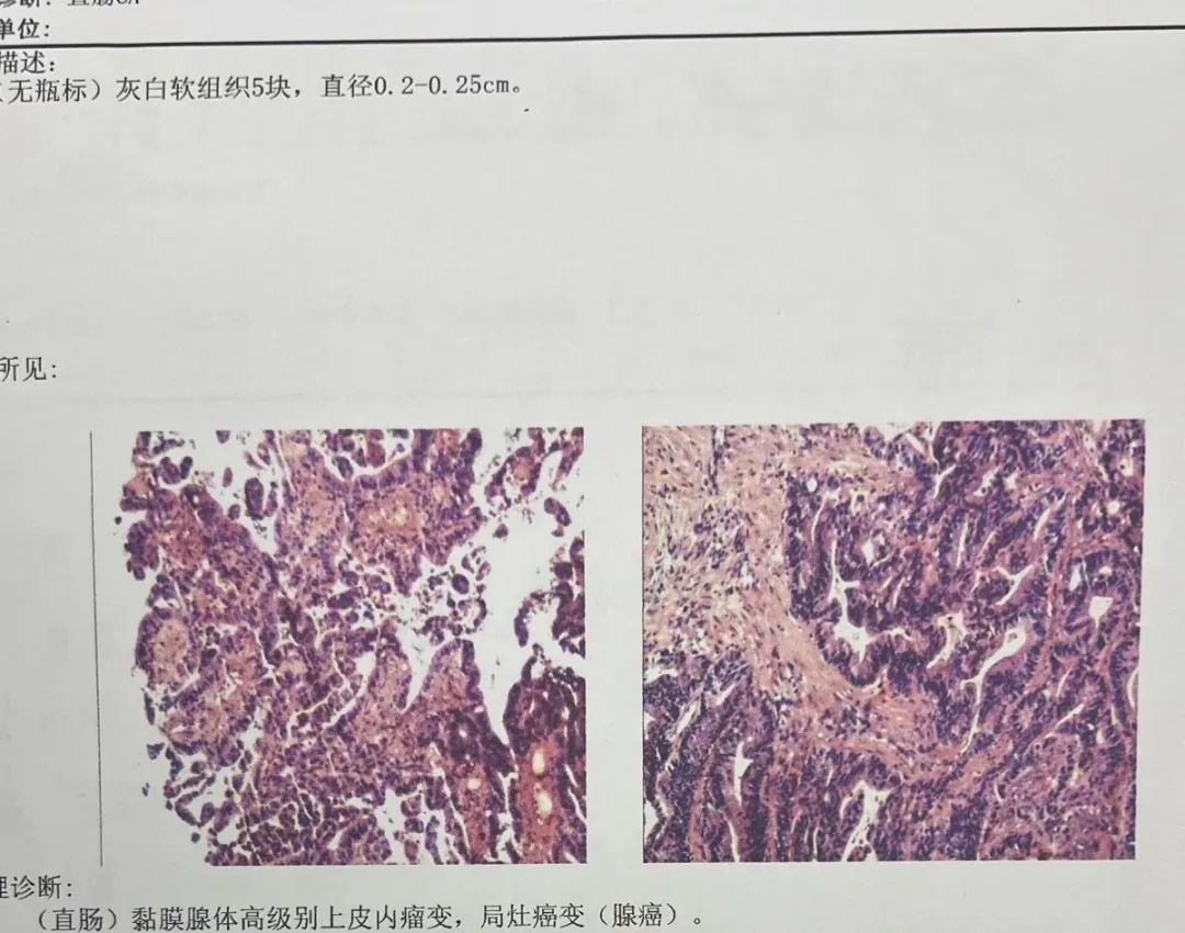 癌症的单子照片图片