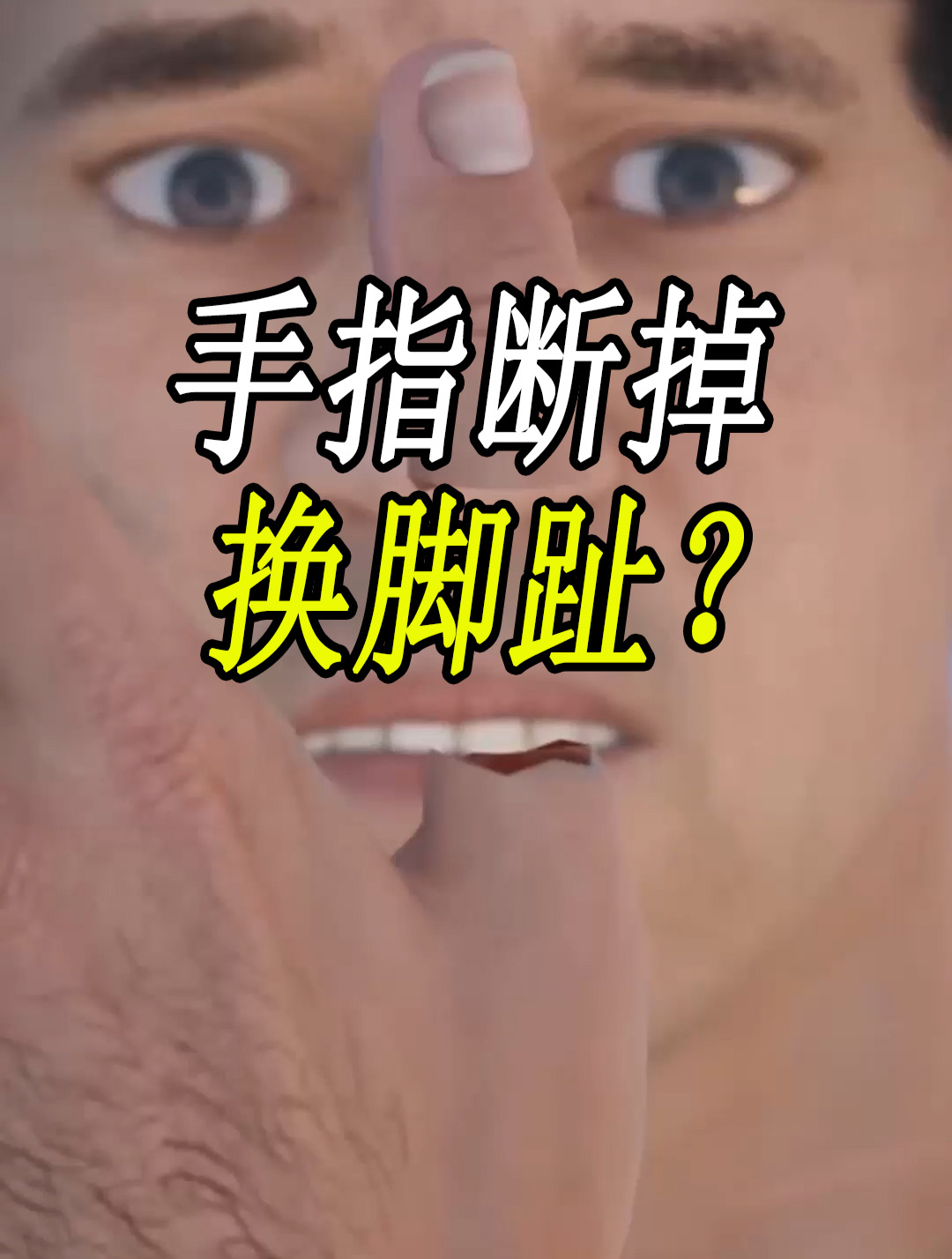 如果断掉的手指头,不能重新接回去!用脚趾头能重新续接吗?