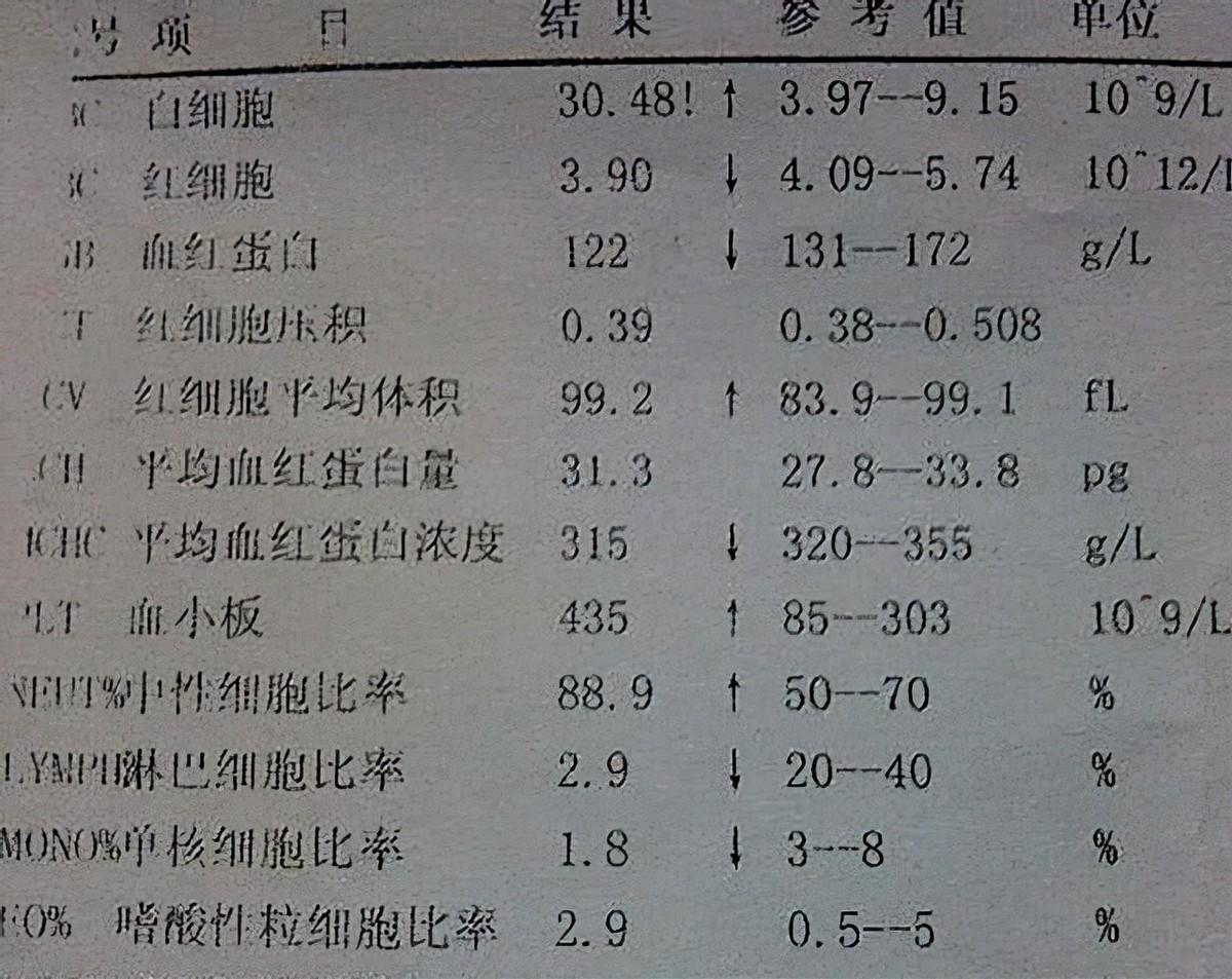 18年养女白血病复发揭开身世谜生父赶来捐髓她谢谢我还恨你
