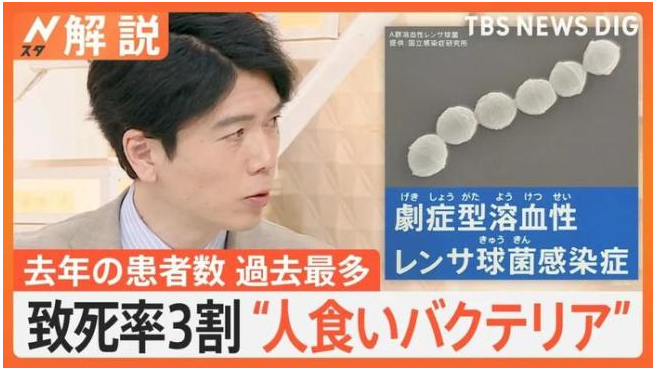 回顾食人菌席卷日本48小时死亡率达30是否会影响到中国