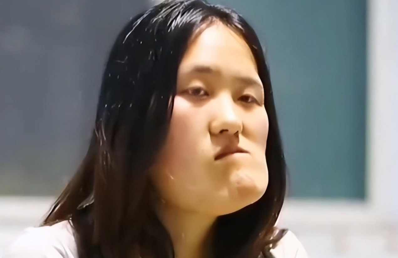 回顾:辽宁歪脸女孩,她整容变女神,拒百万年薪:只想当老师