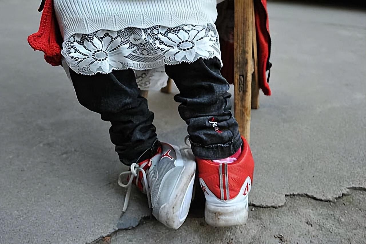 2013年11米畸形袖珍孕妇舍命产子孩子出生后丈夫当场落泪