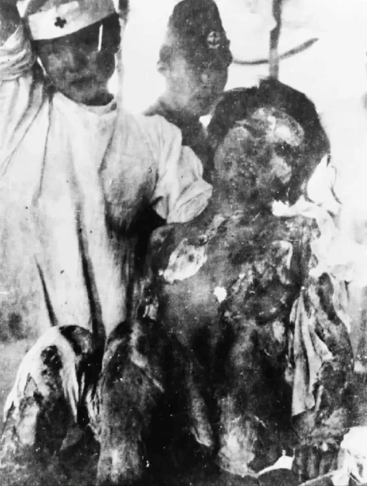 这张照片拍摄于1945年8月10日,日本长崎,一名护士在照顾原子弹爆炸