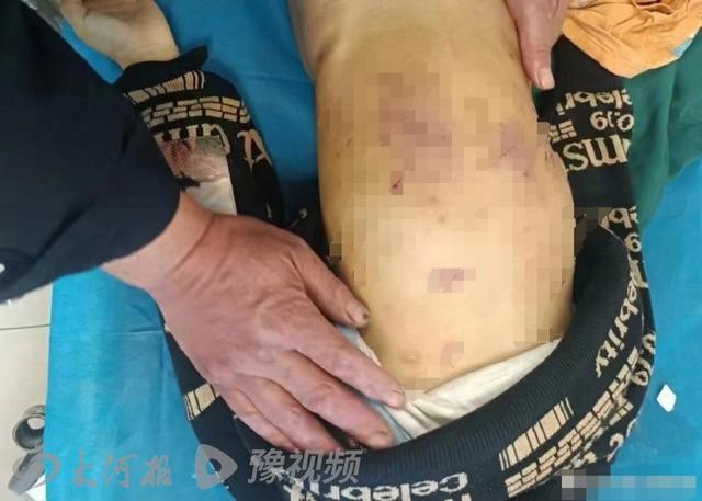 5岁男童身亡送医前监控曝光,悲剧背后真相揭开,引发网络热议!