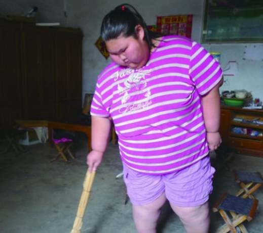 16年山东16岁妙龄少女体重330斤1年后瘦170斤如今吃到370斤