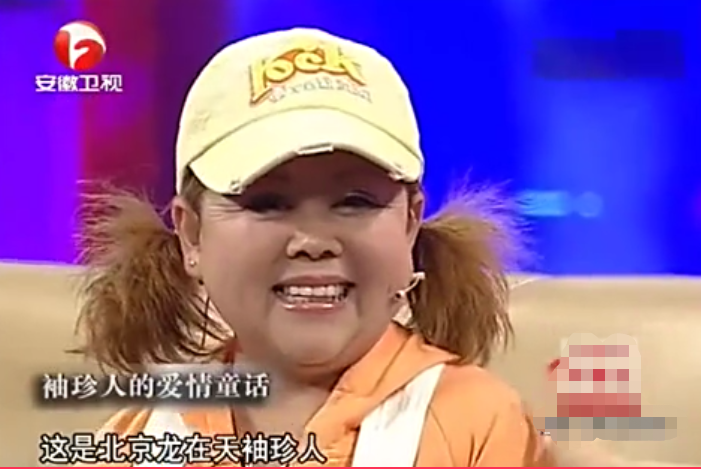 回顾袖珍人朱洁因身高被当成怪物遇上侏儒症的秦学士被宠成宝