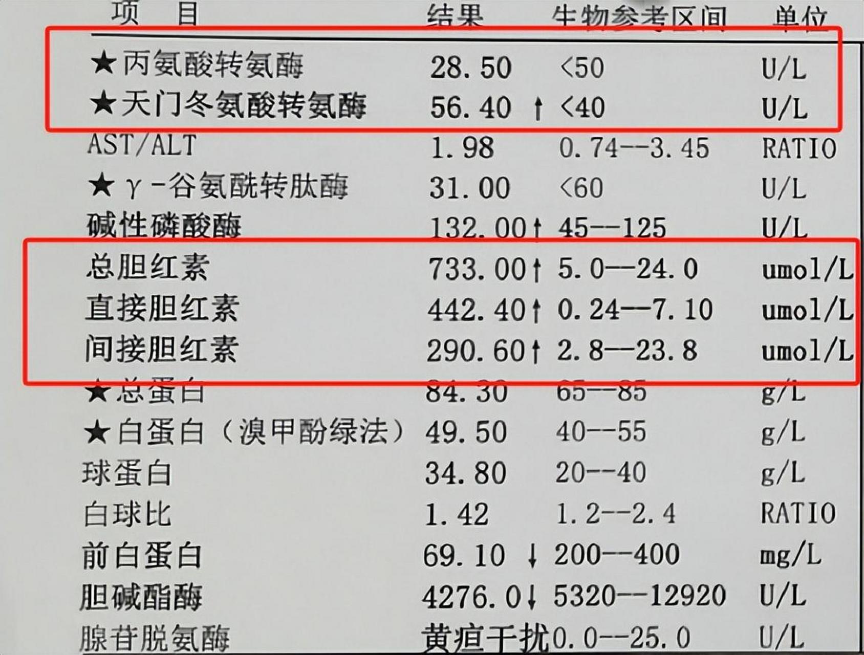 肝功能对照表参考值图图片