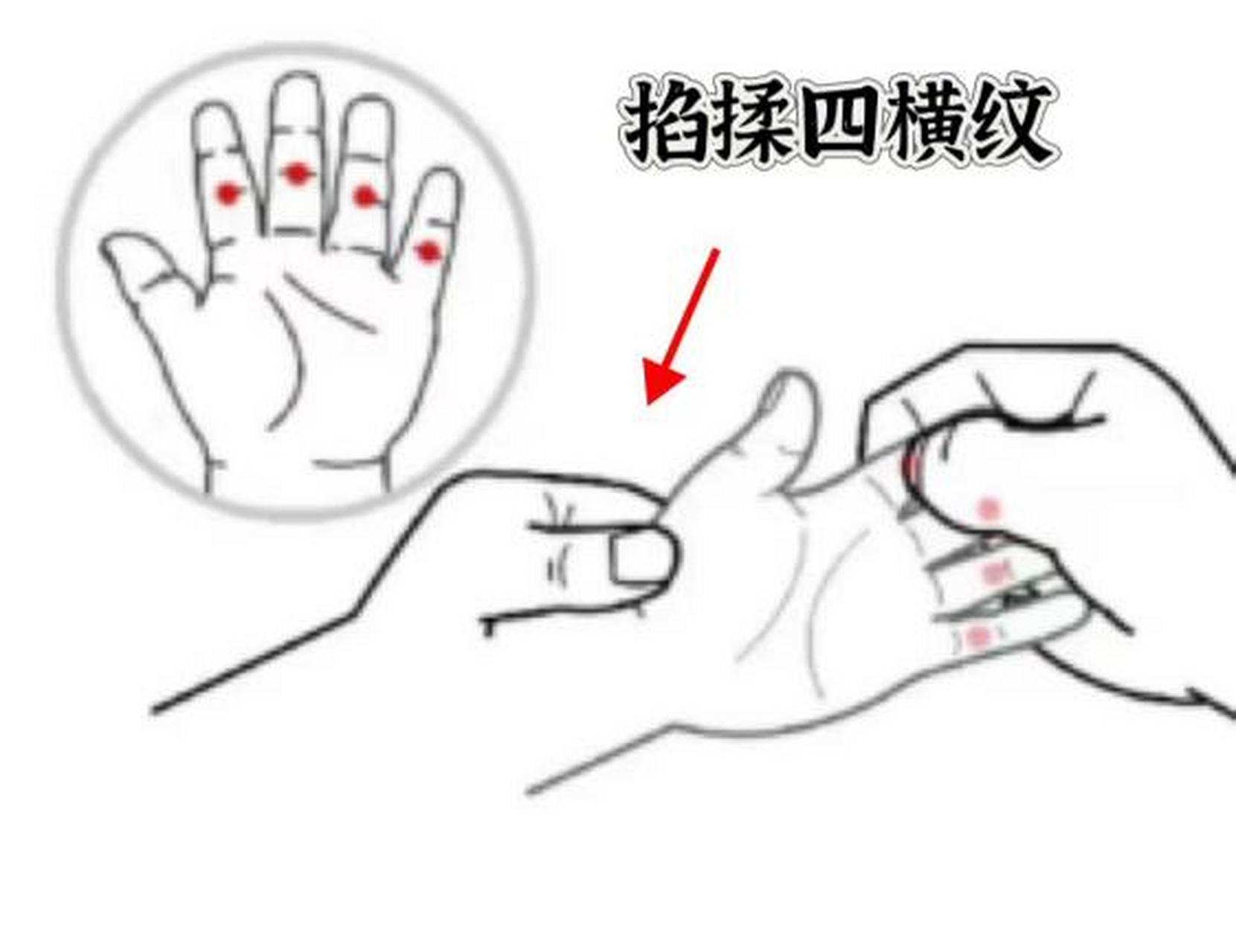小儿推拿有妙招!  1.