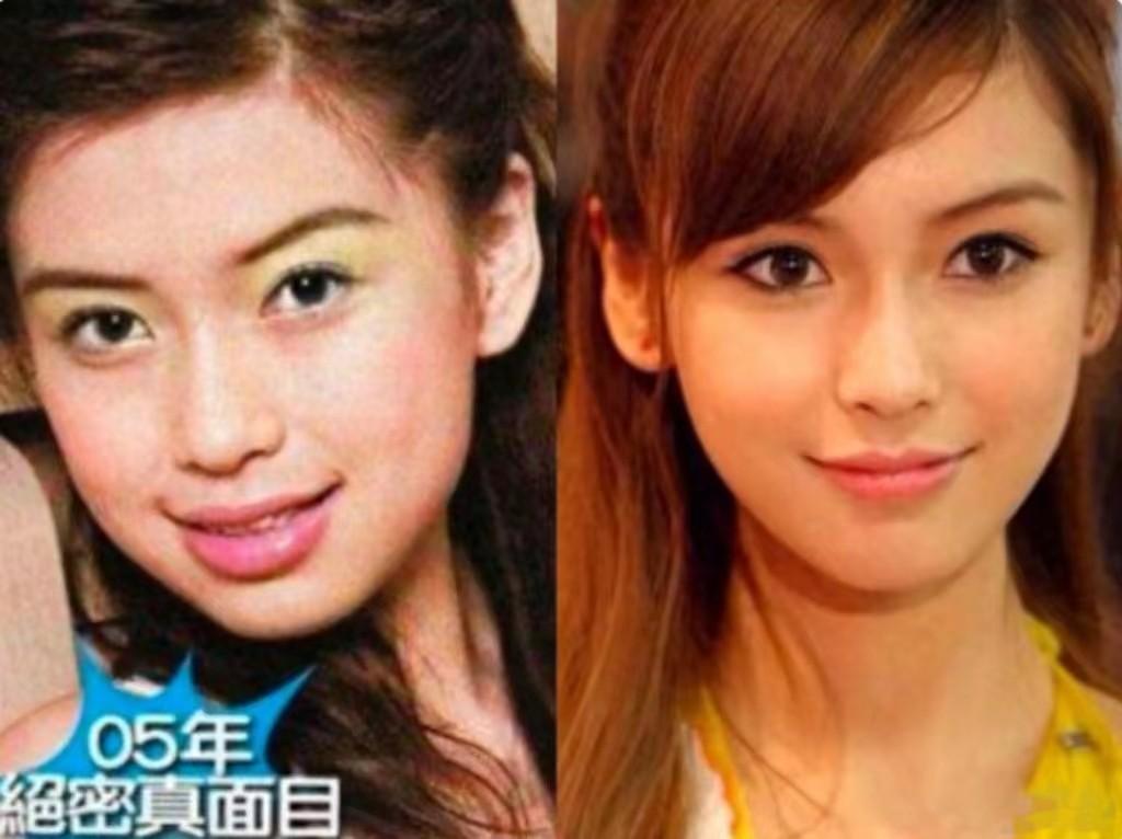 02杨颖——龅牙变女神