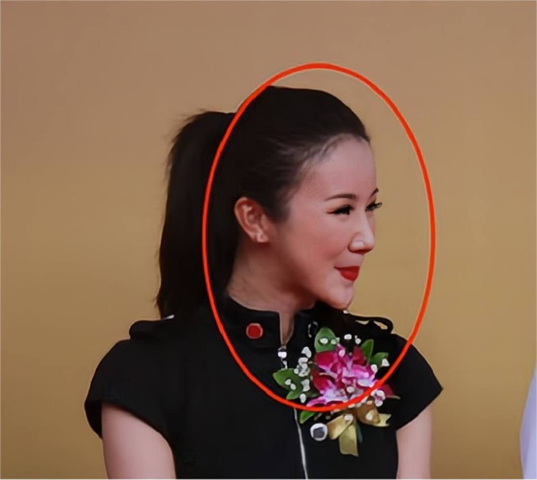 回顾整容害惨了这6大女星明明貌美如花如今成笑容僵硬的怪人