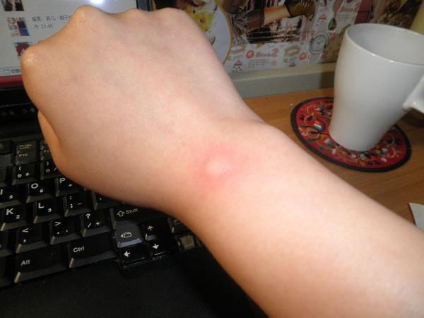 九成人不知蚊子最怕的天敌是啥1笨法整夜开窗也不怕