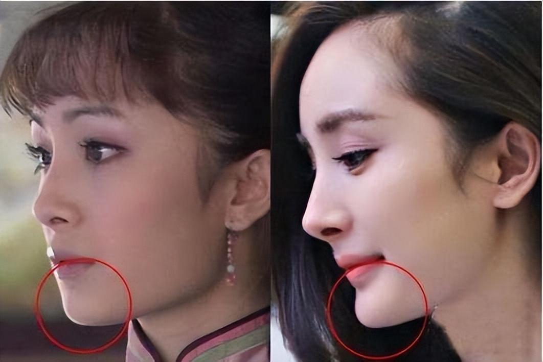 01杨幂——方脸变尖脸