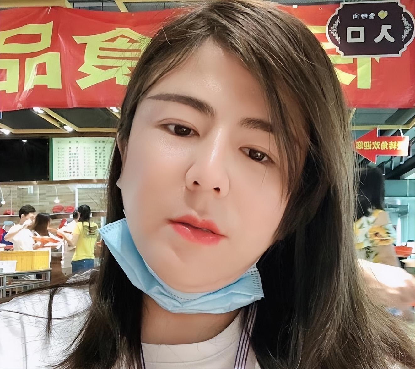 回顾山西女孩雌雄同体兼具男女两性器官10年不敢回家