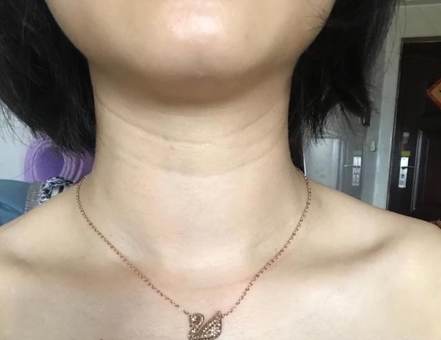 女人脖子上一旦出现"三道杠",就要重视保养了,别傻傻不在意了