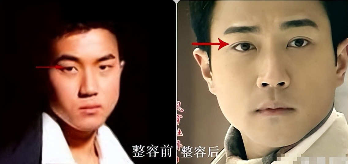 回顾基因骗不了人6位明星换头改命孩子却跟他们整容前一样