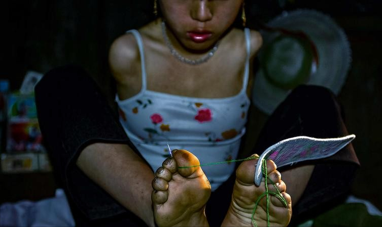 回顾无臂妈妈靠双腿哺乳小6岁丈夫不离不弃含泪再生二胎