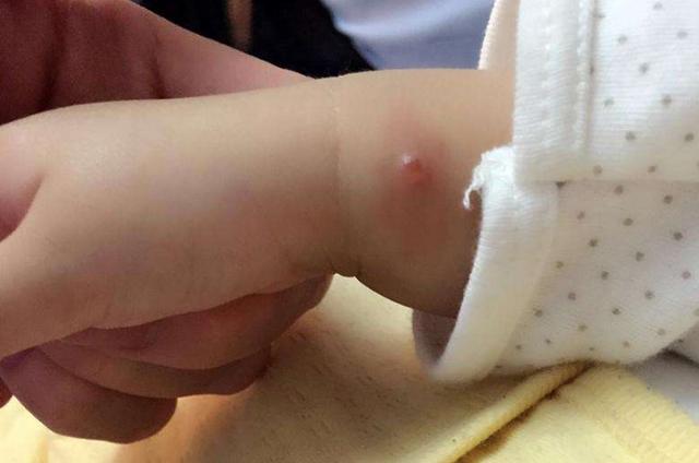 九成人不知蚊子天敌是啥教你招晚上开窗都不怕整夜安睡