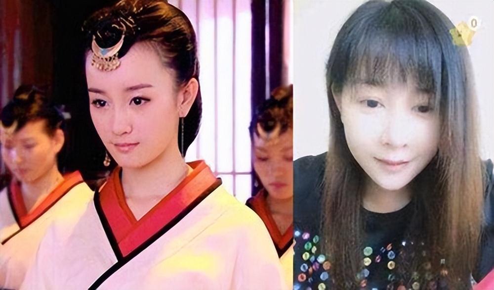 王心凌"脸崩"不是因为整容,而张檬却是真整了.