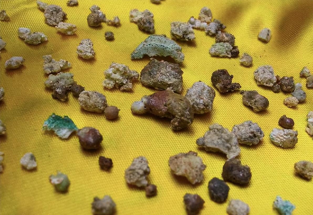 回顾为何高僧火化会有舍利子而普通人只有骨灰舍利子怎么形成