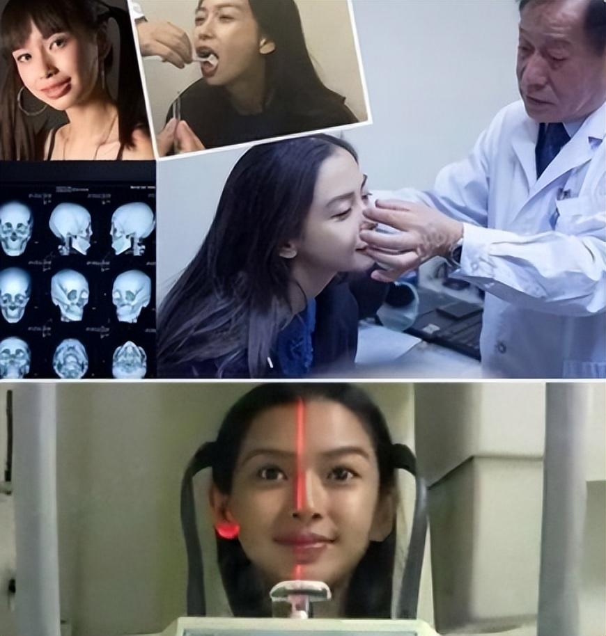 回顾长得歪瓜裂枣整得美若天仙6位女星都靠脸逆天改命