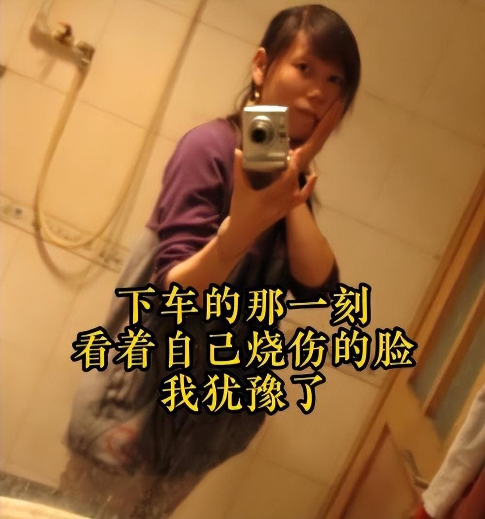 回顾贵州女子9岁烧伤毁容小学文化嫁北大老公如今怎样