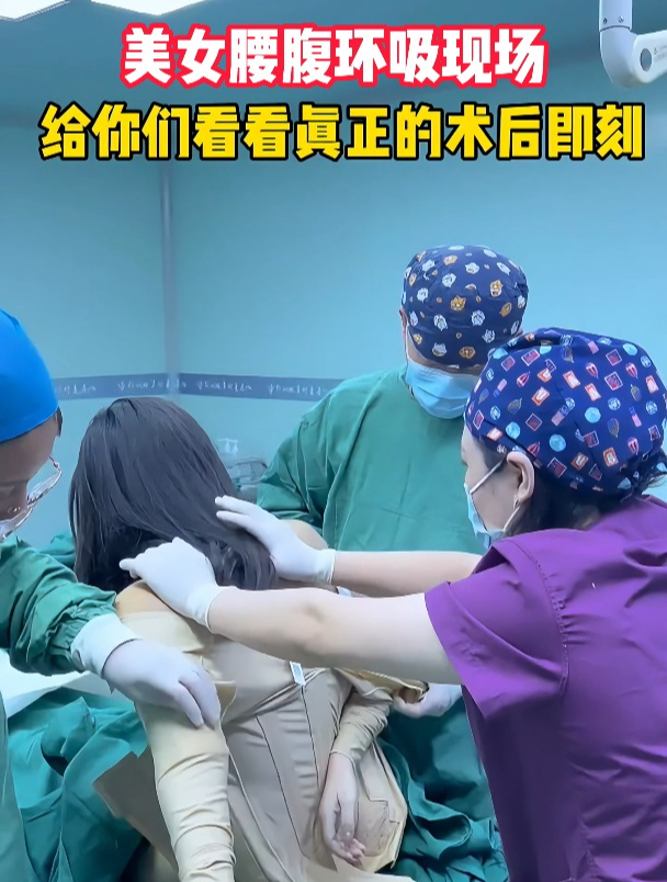 美女腰腹环吸现场,给你们看看真正的术后即刻
