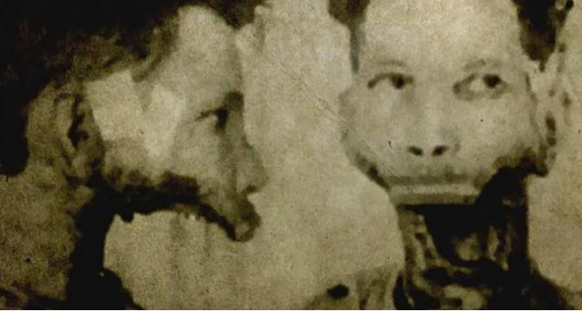 拜尔斯的身体素质可以说非常好,但在1927年的时候,发生了一件意外