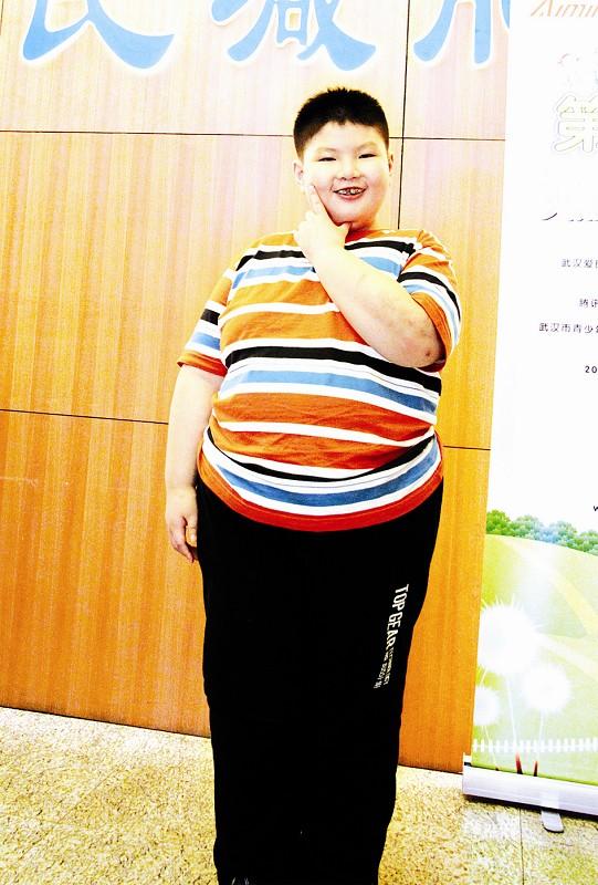 回顾中国小胖徐周磊14岁体重300斤一顿狂吃8碗饭结果如何