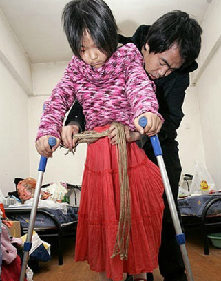 回顾因车祸失去双腿靠篮球行走的云南女孩终获残运会冠军