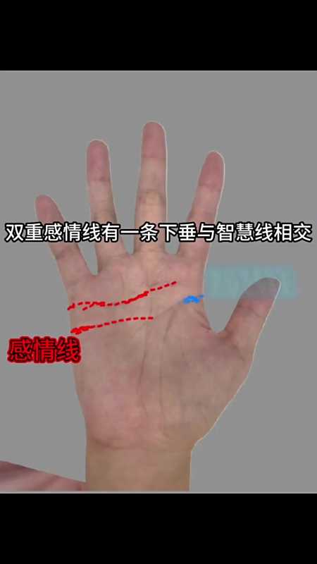 双重感情线有一条下垂与智慧线相交