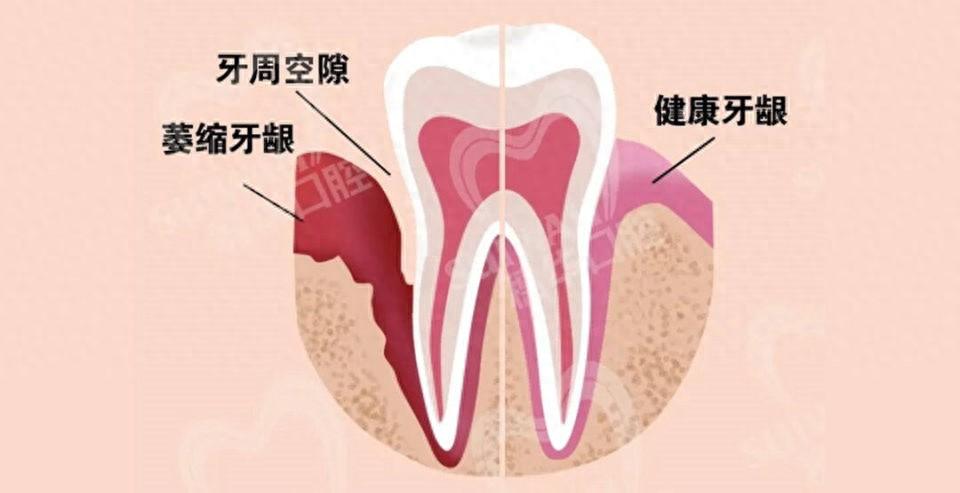 下牙床是哪个部位图片图片