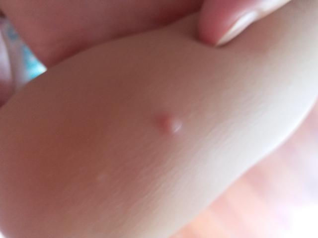 九成人不知道蚊子怕的天敌是教你个土方子晚上开窗也安睡整夜