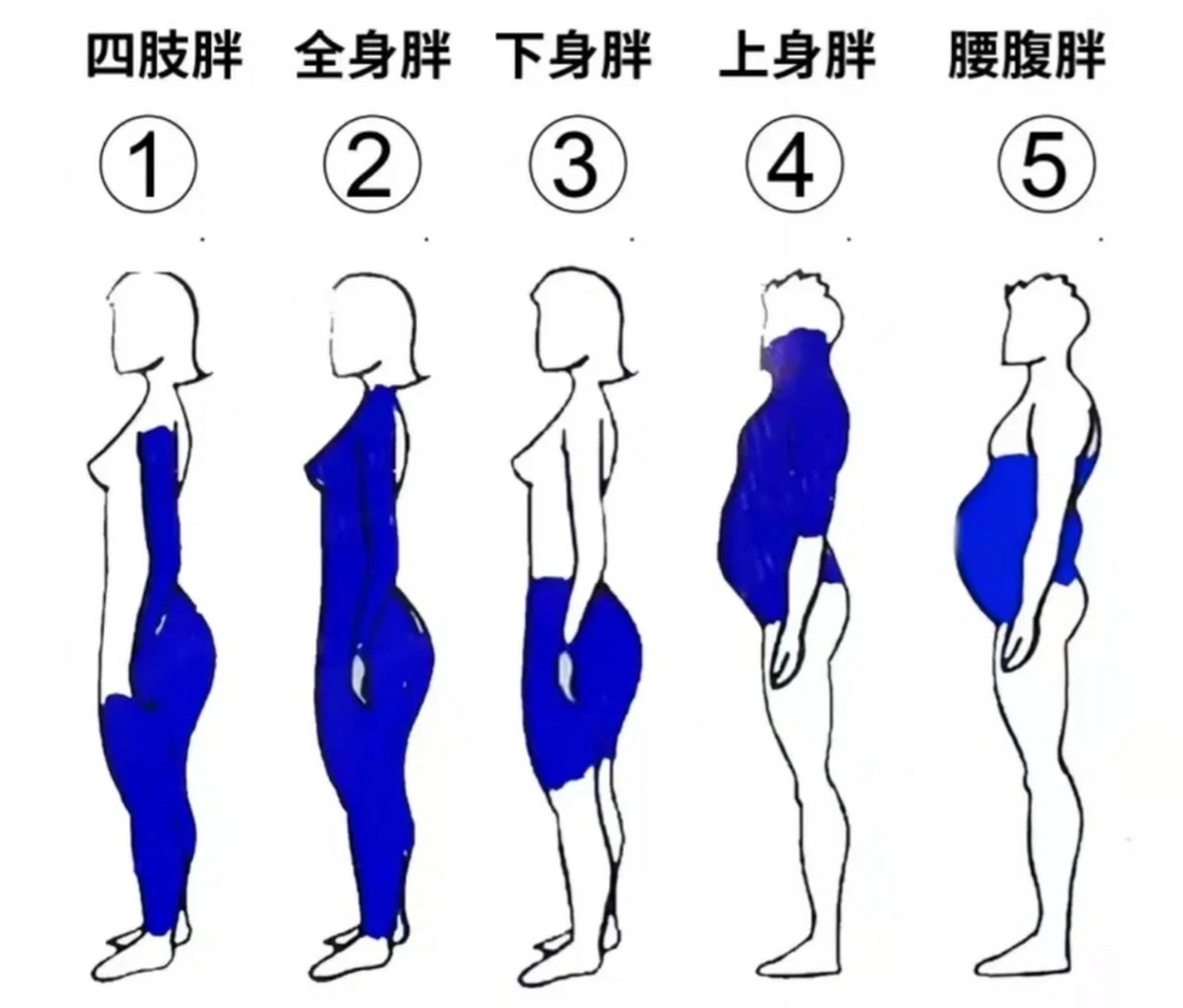 肥胖对照图图片