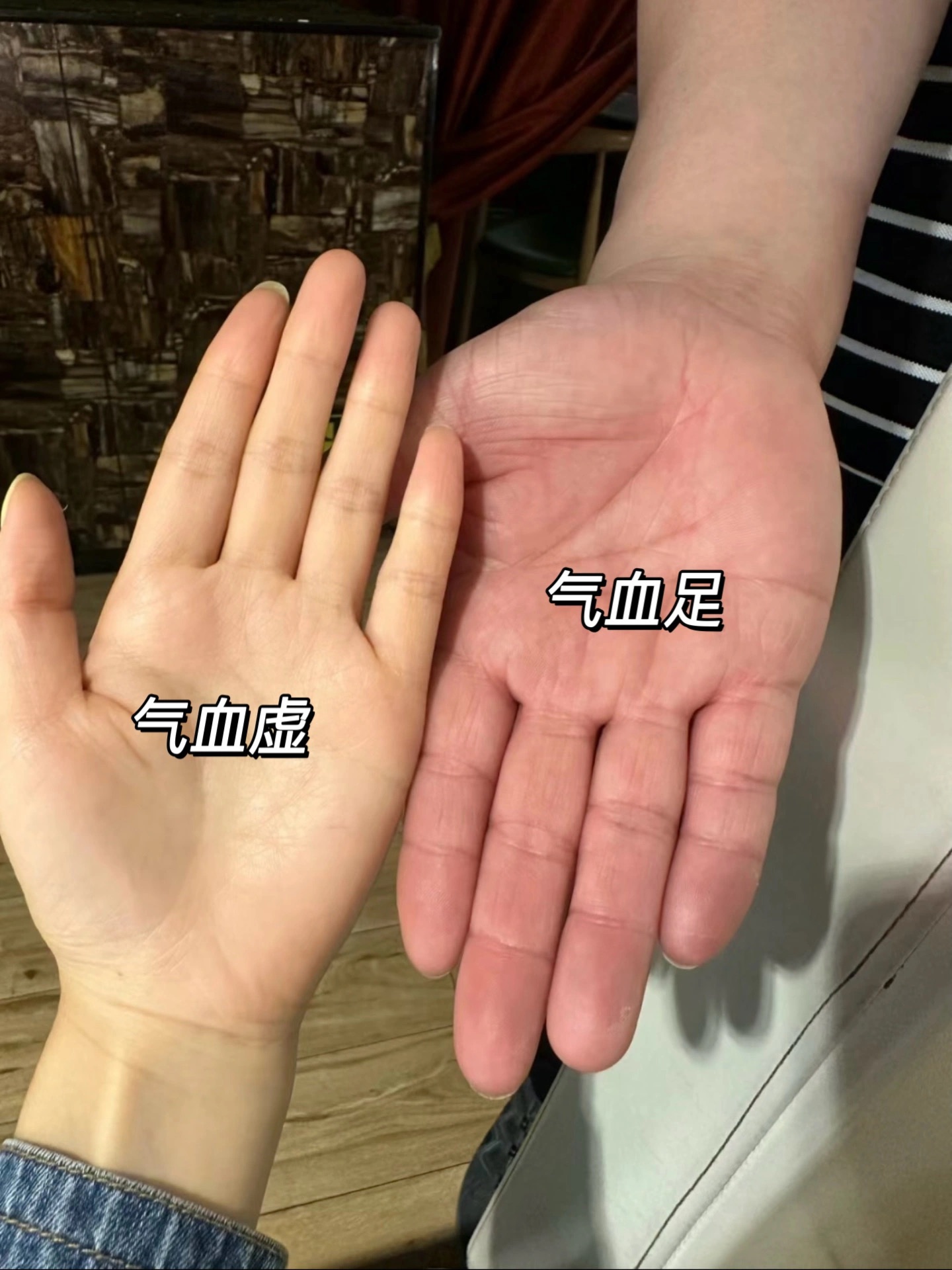 气血不足手掌这么明显!