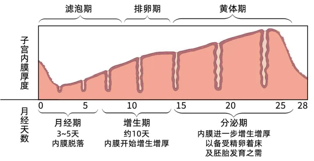 子宫内膜炎的症状图片