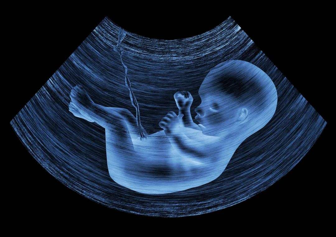 孕四个月胎儿图图片
