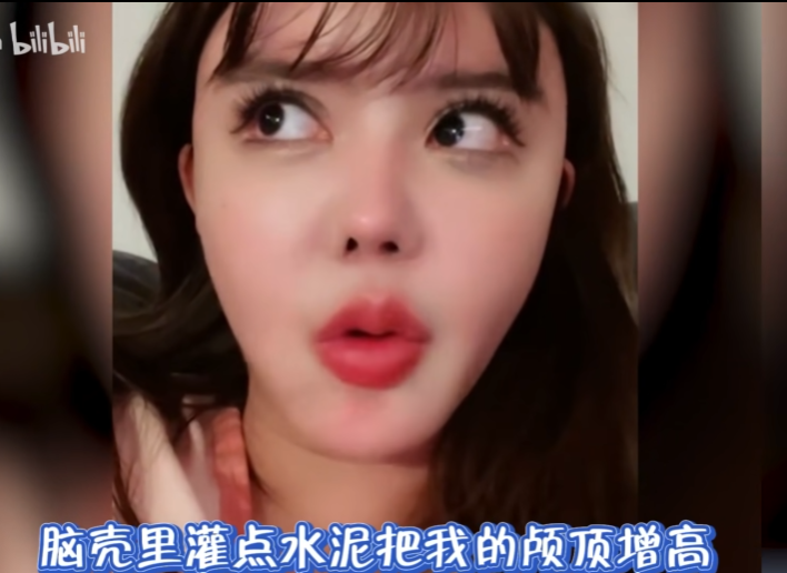 回顾那些整过头的网红韩安冉活到老整到老网红帅小伙整成大叔