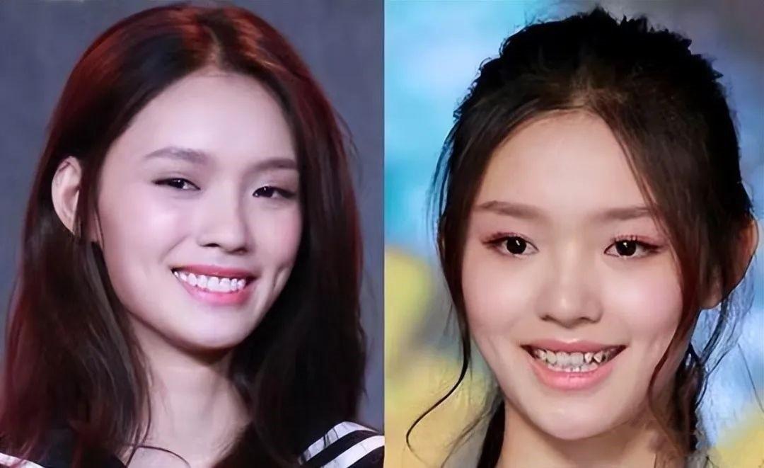 明星烤瓷牙有多可怕有的亮得发蓝有的嘴包不住牙辣眼睛