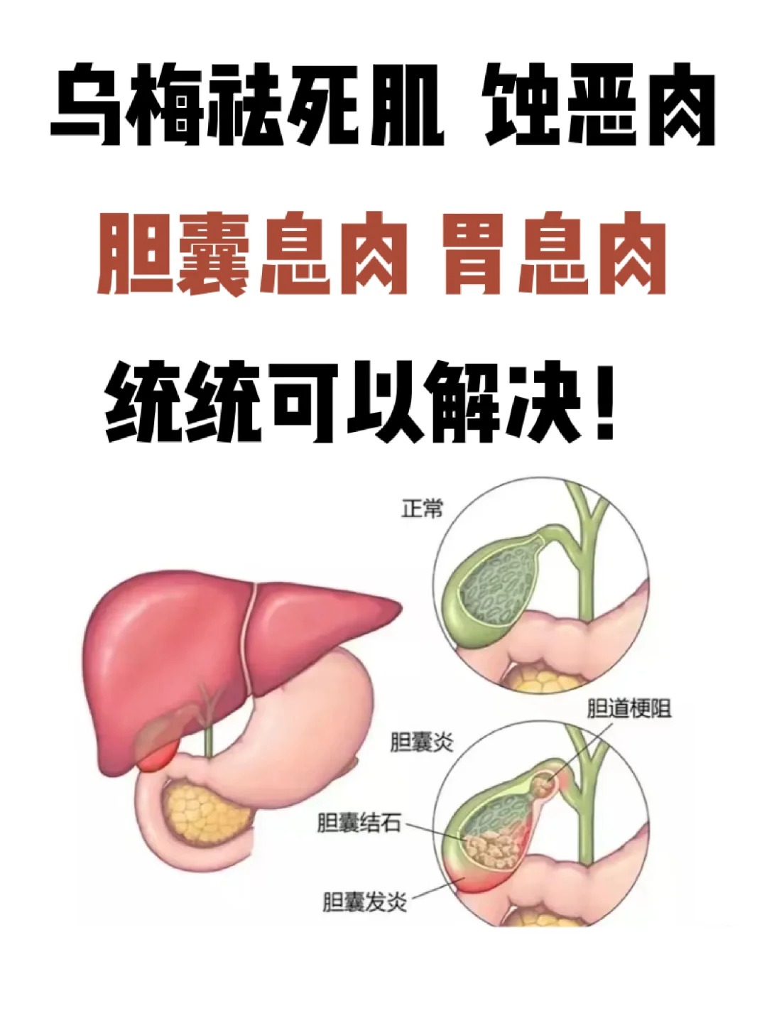 其中胆囊息肉胃息肉肠息肉和声带息肉都是较为常见的息肉类型