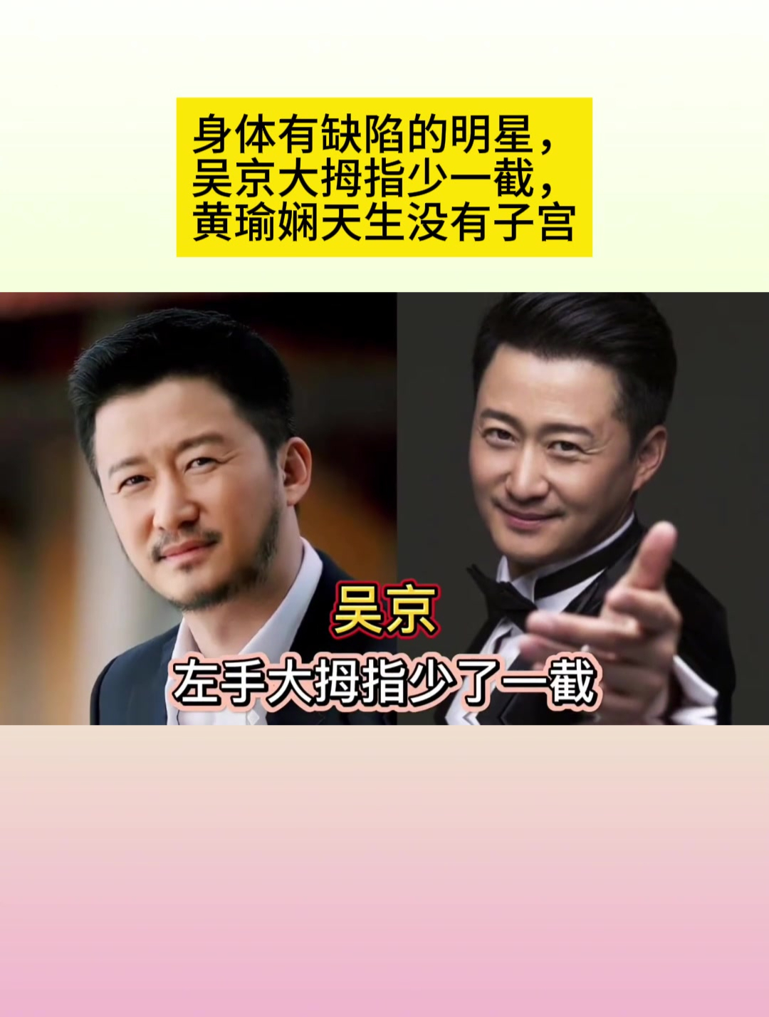 身体有缺陷的明星,吴京大拇指少一截,黄瑜娴天生没有子宫