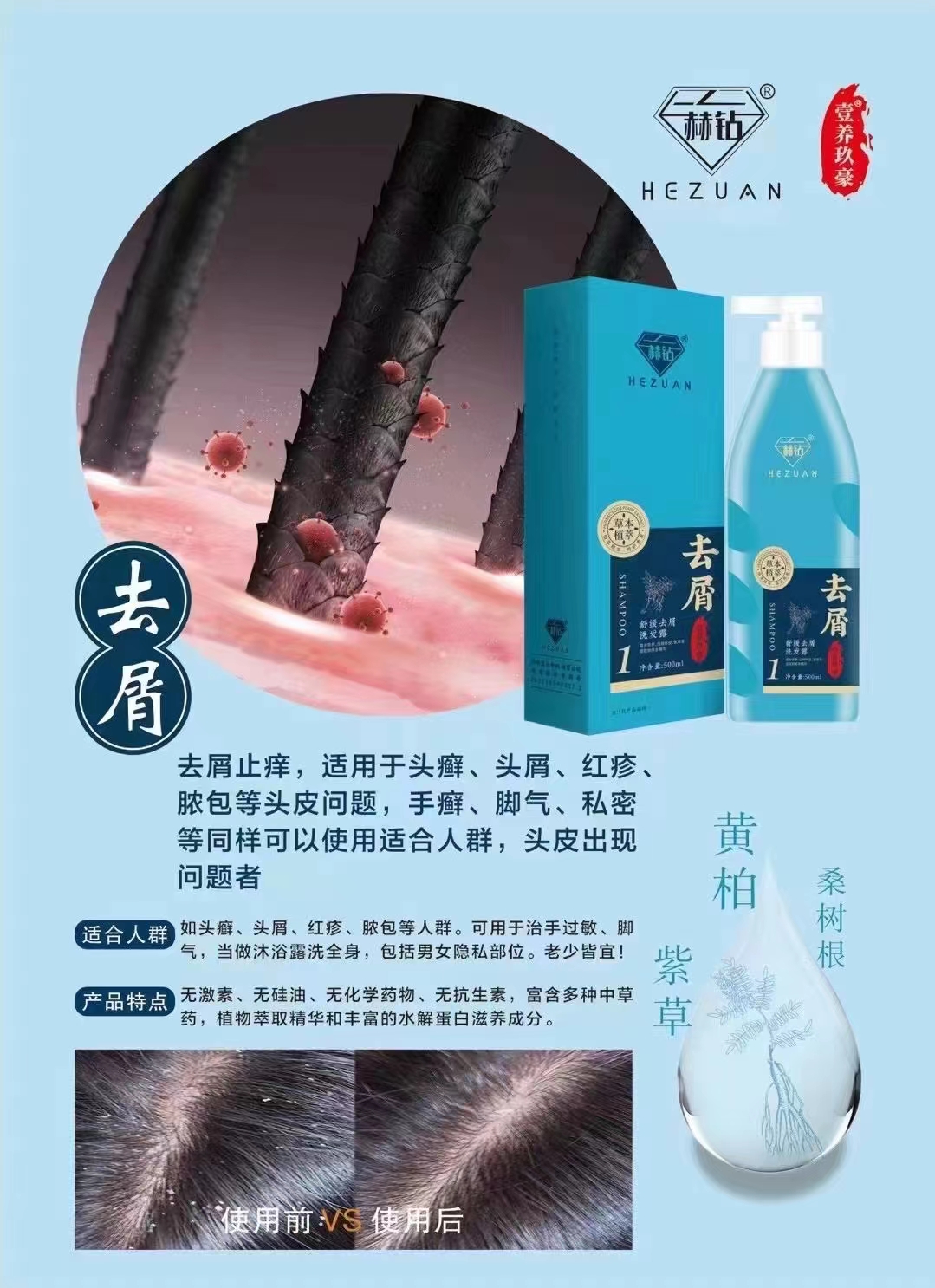 头皮屑特别严重怎么办 10个去屑小妙招