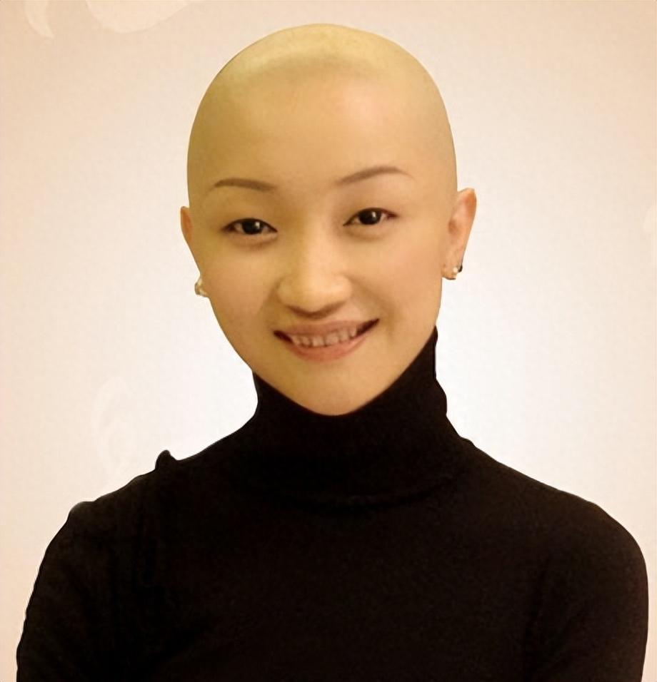 回顾那个曾被嘲脸歪嘴歪逼婚高富帅的张瑶如今活成了人生赢家