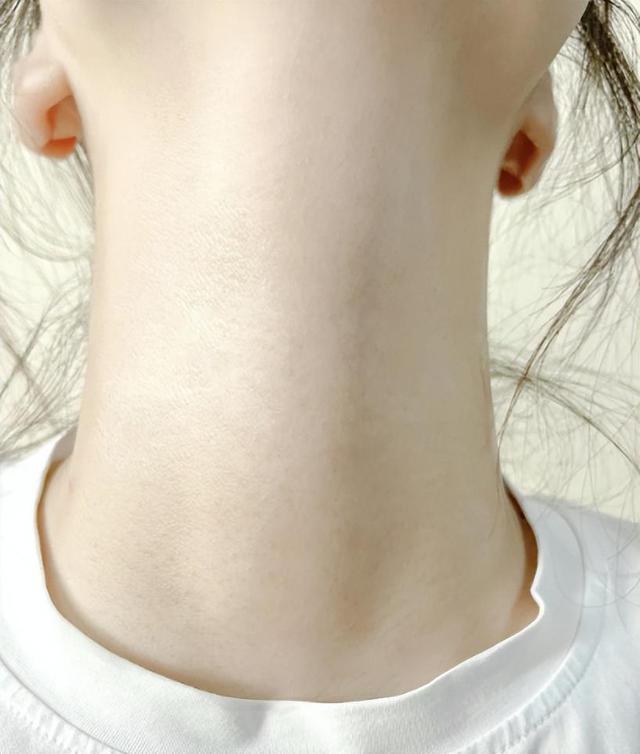 女人脖子如果出现3道杠,那是意味着什么呢?要提前了解