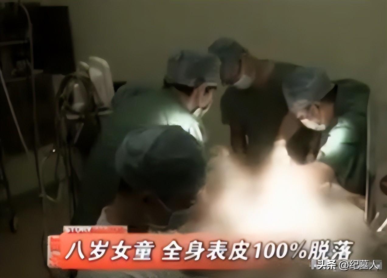 15年武汉8岁女孩患怪病靠全身移植猪皮续命离奇身世让人泪崩