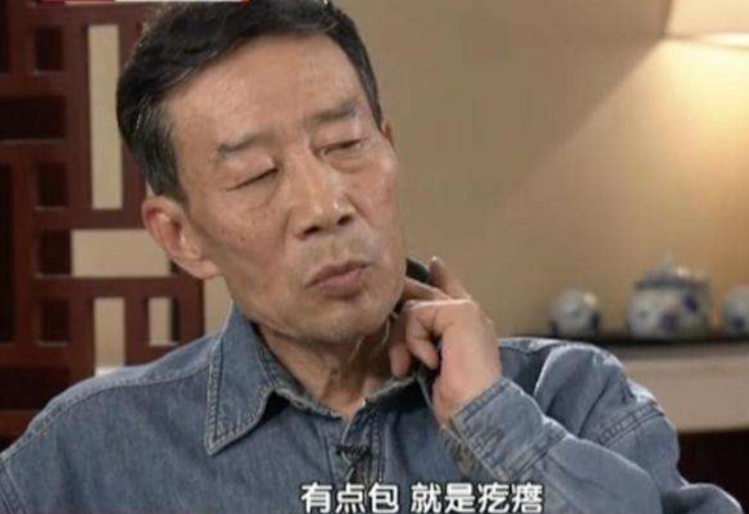 李雪健觉得可能只是被蚊子咬的包,不值得大费周章.