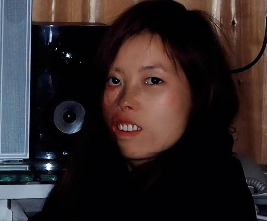 回顾北大高才生娶农村毁容女宠妻17年后妻子回馈千万资产报恩