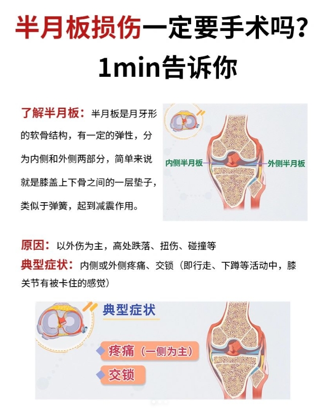 膝关节半月牙图片图片