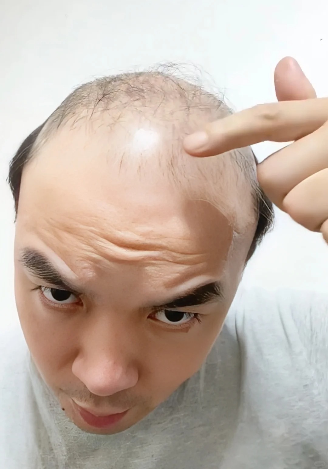 防脱发洗发水怎么选择呢?助你拥有浓密秀发